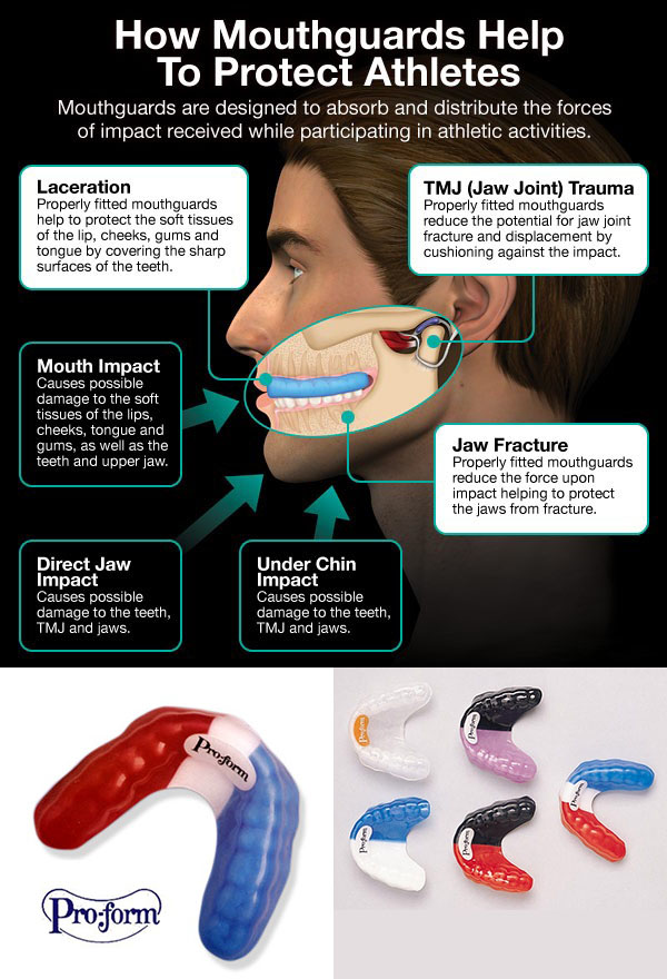 Mouth Guard Cape Town Mouth Guard Cape Town