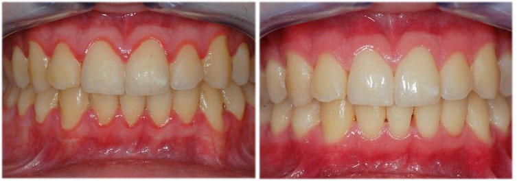Oral Hygenist Cape Town Oral Hygenist Cape Town