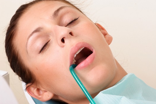 Sedation | Dentist Bellville